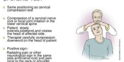 Cervical spine special tests